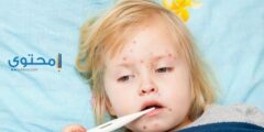 تفسير المرض بالحصبة فى المنام 2026