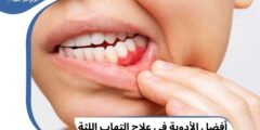 قائمة اسماء أفضل 4 أدوية في علاج التهاب اللثة 2026