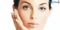 وصفات سعيد حسانين لتفتيح البشرة 2026
