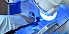 تجربتي مع العلاج الإشعاعي ونتائجه وآثاره الجانبية 2026